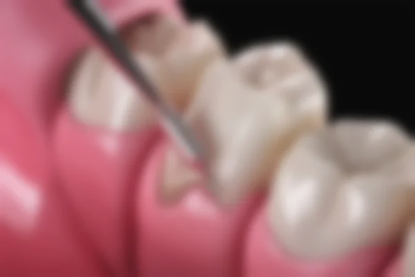 江苏常州美奥口腔种植牙价格大公开，韩国奥齿泰5500元起，全口71219 - 255809元 